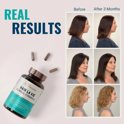 HAIR LA VIE Clinical Formula Volume Density Hair Growth Shine Multivitamin 90Ct