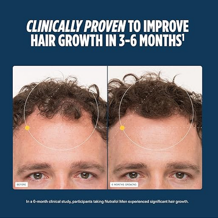 Nutrafol Men's Hair Growth Supplements, Clinically Tested for Visibly Thicker Hair and Scalp Coverage, Dermatologist Recommended - 1 Month Supply