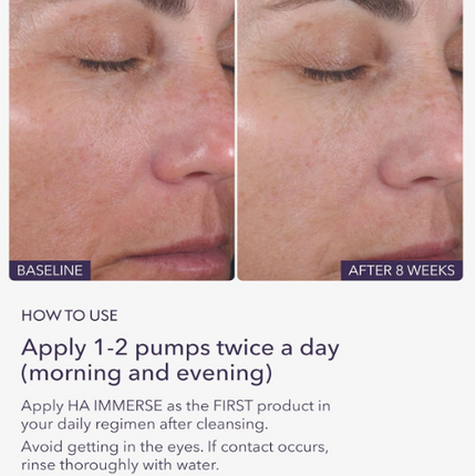 ALASTIN Skincare HA Immerse Hydrating Face Serum (1 oz) | Deep Moisture & Skin Renewal | Revives Dry, Dehydrated Skin for a Radiant Glow